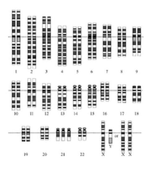 This human karyotype is unusual because chromosome seta. 5 has chromosomes of different shapes