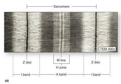 Which of the following would decrease in size during the contraction of a sarcomere?  the width of t