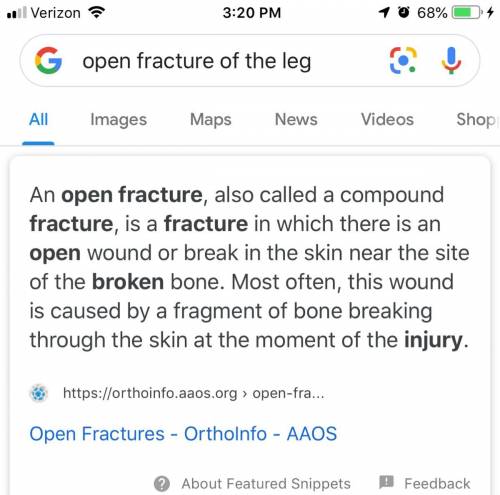 For an individual with an open fracture of the leg