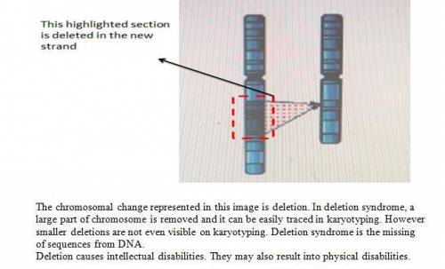 Which chromosomal change is represented?  a.) deletion b) translocation c)inversion or d)insertion