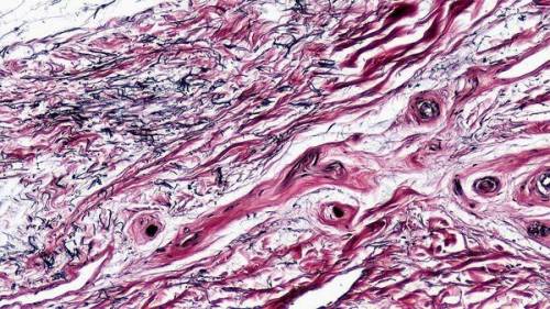 Correctly identify this tissue type and then label the features of the tissue.