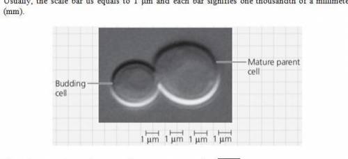 Note that the scale bar under the photo is labeled 1 μm (micrometer). The scale bar works the same w