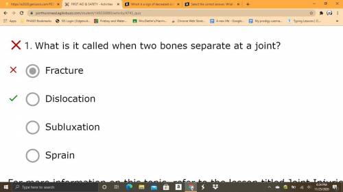 Select the correct answer.

What is it called when a bone is only partially dislocated?
A. 
Fracture
