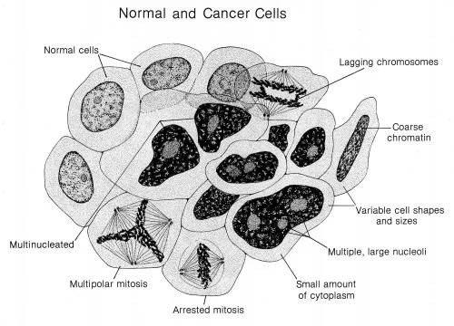 HELP EASY 5TH GRADER WORK

I am having difficulties finding a cancer cell model that shows organelle