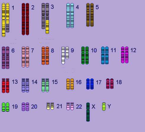 Describe an individual with the karyotype shown?