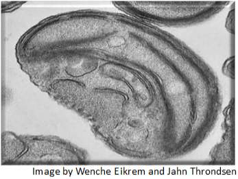 What is shown in the image?  prokaryote eukaryote chloroplast &lt;