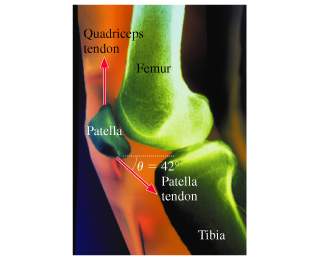 What size force does the femur exerts on the kneecap if the tendons are oriented as in the figure an