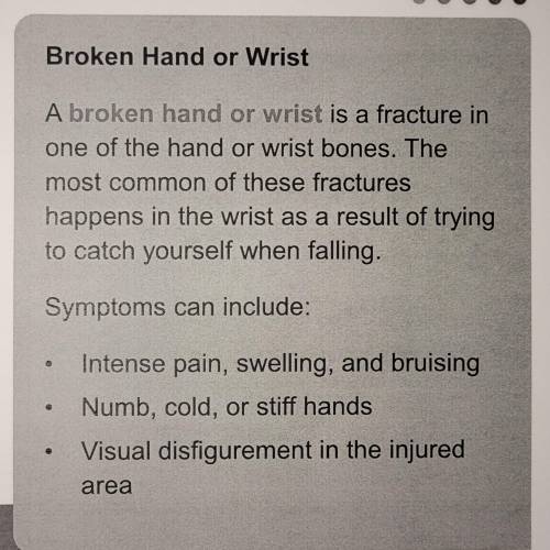 The most common type of hand/wrist fracture occurs from car accidents.

OA.
True
OB.
False