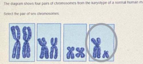 The diagram shows four pairs of chromosomes from the karyotype of a normal human male.

Select the p