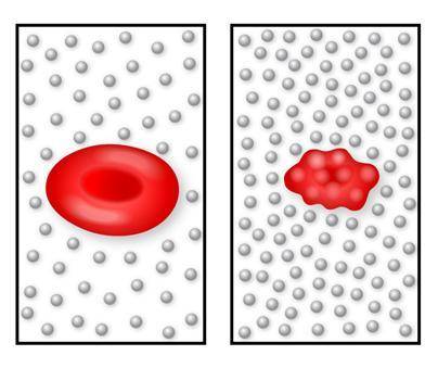 The diagram shows a normal red blood cell and a shrunken red blood cell, both of which are in salt w