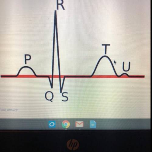 Which channels are open and closed in each phase of this ekg?