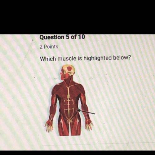 Which muscle is highlighted below? A. Biceps brachii B. Obliques C. Rectus abdominal D. Latissimus d