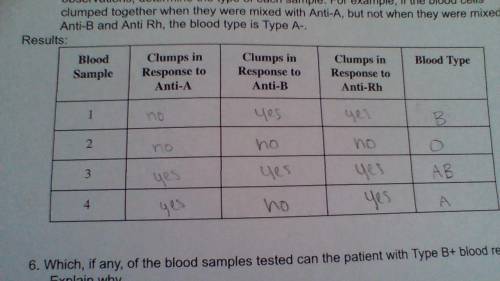 Which, if any, of the blood samples tested can the patient with Type B+ blood receive?

Explain wh
