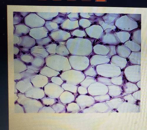 Which level of organization is shown in the image? Cell. Tissue. Organ. Organ system. Cobblestones