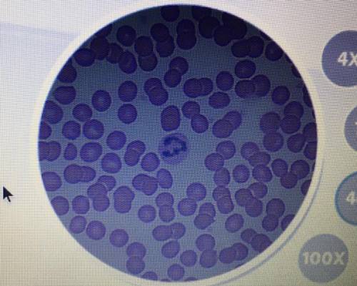 Hey y’all, how many human blood cells are in the circle pls help I can’t count lol