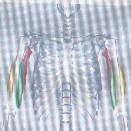 Which muscle is displayed in the picture?