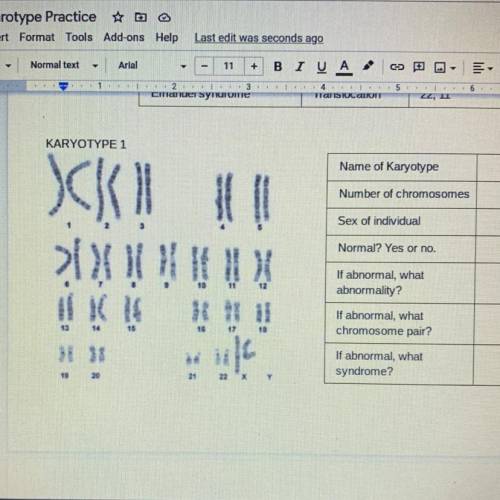 KARYOTYPE 1

•Name of karyotype ?
•Number of chromosomes?
•Sex of individual?
•Normal? yes or no?