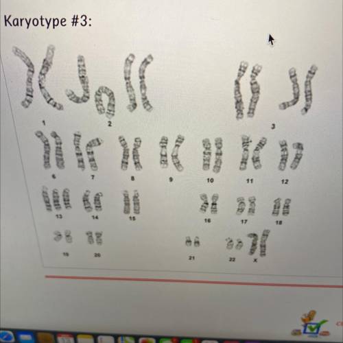 What type of syndrome is this Karyotype
