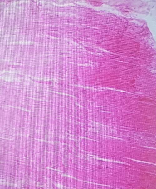 The following is a picture of what type of tissue?​