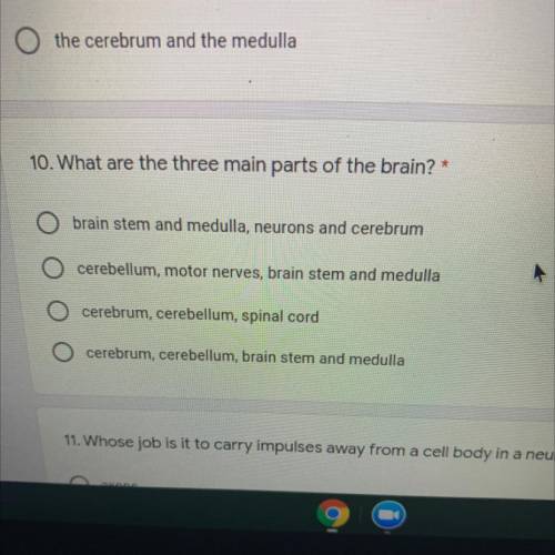 Which of the following is a part of the nervous