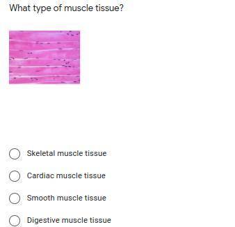 What type of muscle tissue is this