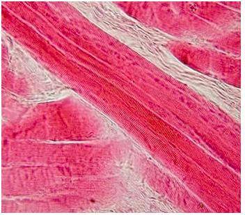 HELP!!!

What is the function of the type of muscle that is pictured below?
Skeletal muscle.
suppo