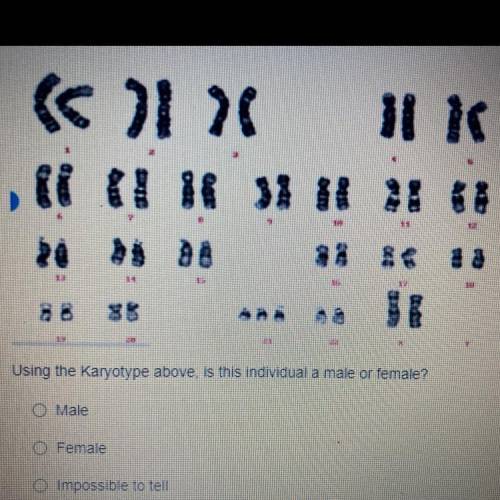 Using the Karyotype above is this individual a male or female?

male
Female
Impossible to tell
