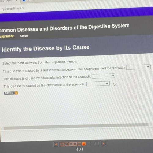 Select the best answers from the drop-down menus.

This disease is caused by a relaxed muscle betw