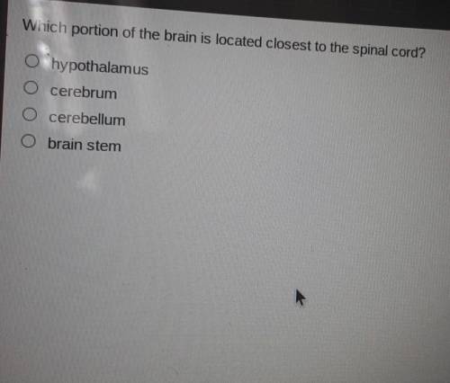 Could someone pls helpp!!

which portion of the brain is located closest to the spinal cord?1. hyp