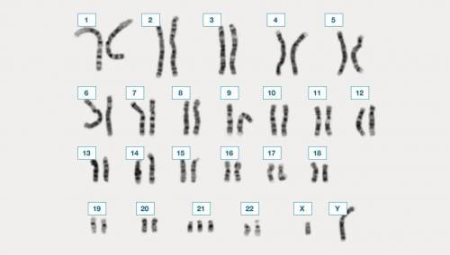 What would this chromosomal combination result in?