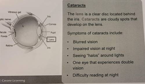 Which of the following IS a symptom of cataracts?