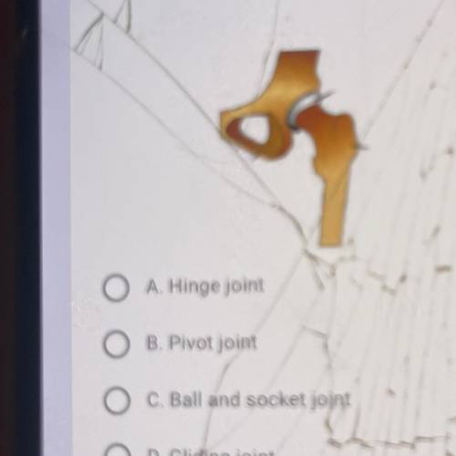 Identify the following joint