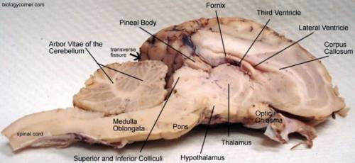 Identify the structures of a sheep brain (midsagittal section), and write the brain region with whic