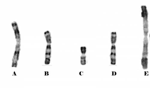 Which pair are homologous chromosomes?
PLLZZZZ
